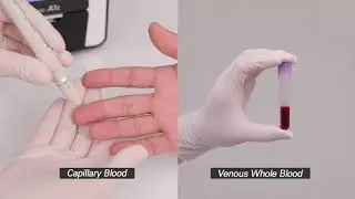 GREENCARE A1c Manual Capillary Sample