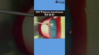 Spinal Anesthesia | How spinal is given | Epidural Anesthesia #rirssurgery #pregenency