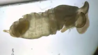 Sipunculid and Polychaete larvae