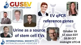 GUSEV: Urine as a source of stem cell EVs and EV qPCR reference genes