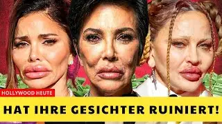 7 Prominente Vor und Nach Schönheitsoperationen | Früher und Heute 2025