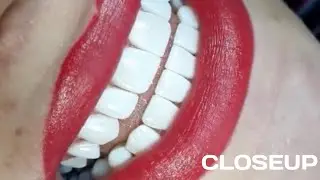 Gigi Putih istimewah,SmileCloseup