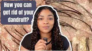Simple Steps to Beat Dandruff Fast!