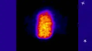 3 December 2025 - Lund University Bioimaging Centre Christmas Calendar