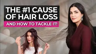 The #1 Cause of The Hair Loss Ft. Dr. Fazeela abbasi