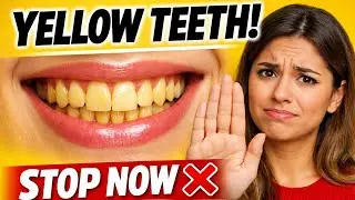 Yellow Teeth Problem | दाँत पीले क्यों हो जाते हैं? STOP NOW ❌
