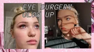 GLOW UP AFTER EYE SURGERY: Alyssa McKay