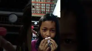 Cabut gigi pakai tang. Bocah ngapa[k] ya.