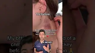 In case you need help with your hickey 😅 #hickey #doctor #medical