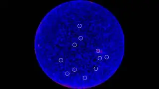 Blazar activity observed by Fermi