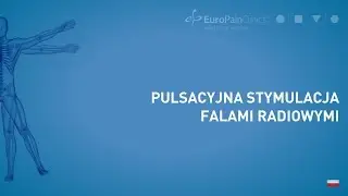 PULSACYJNA STYMULACJA FALAMI RADIOWYMI