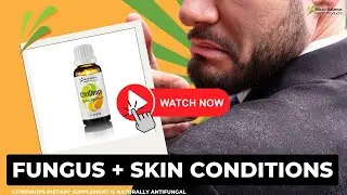 Is Your Skin Issue Caused By a Fungus?!  #fungus  #mold