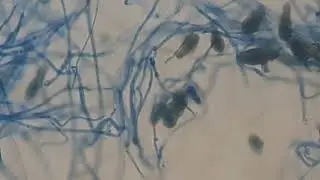 Curvularia in LPCB preparation