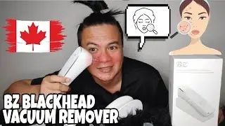BZ Electric Blackhead Extractor | Blackhead Remover Vacuum |Unboxing | Felice Tamayo