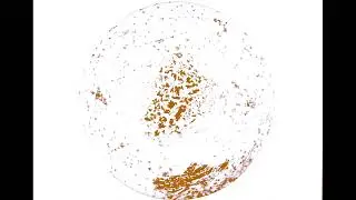NEUTRALIZING TOXOPLASMA GONDII PARASITES | SCALAR ENERGY FIELD ( TESLA COIL )