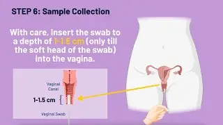 TouchBio Chlamydia & Gonorrhoea Self-Test- For Female | Monitor your Sexual Health at home- STI Test