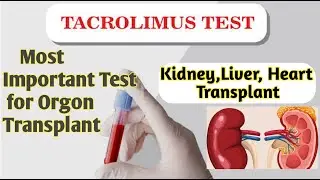 Tacrolimus blood test | Tacrolimus test