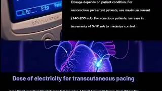 Temporary Pacemaker Part 3 (Percutaneous Temporary Pacemaker)