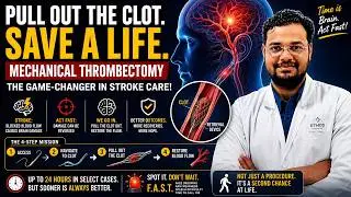 Stroke can be reversed &mdash; if treated on time!🧠🚨