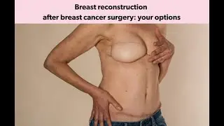 Breast Reconstruction Webinar