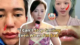The Disturbing Asian Beauty Trend Makes People Smile Forever！！！
