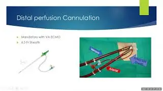ECMO Introduction for ED: Types of ECMO Modalities / Cannulation strategies