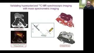 Stanford Radiology: CEDSS (Fall) 2022, Brindle: Imaging Tumor Metabolism &ndash; From Mouse to Man