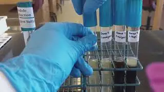 Biochemical Tests - Indole Production Test