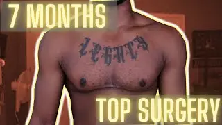 7 Months post op | Double Incision | Dr. Scott Mosser // Black ftm