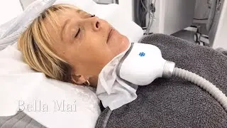 Double Chin Fat Freezing