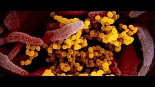 Revised coronavirus model predicts fewer deaths
