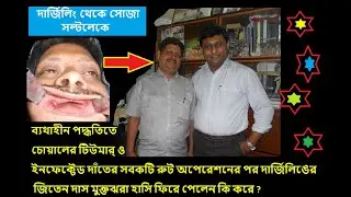 #দার্জিলিঙের_জিতেন_সাংঘাতিক_মুখ_ও_দাঁত_থেকে_মুক্তঝরা_হাসি_ফিরে_পেলেন_কি_করে_?#painlesssurgery