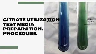 Citrate utilization test media preparation, procedure, Result