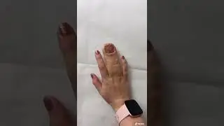 3 Finger😱🤔 #shorts #finger #fyp #ytshorts