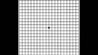 Grid for Macular Degeneration