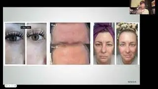 This Changes Everything  Doctor Approved Breakdown of RIMAN by Dr  Stephanie Rimka 720p60fps 2