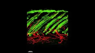 JID September 2023 Cover: Three-Dimensional Reconstruction of Mouse Skin in Early Catagen