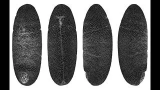Whole embryo unsegmented