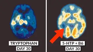 We Finally Know How To Boost Serotonin Naturally