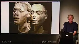 Elongated Skull Phenomenon  Global Presence, DNA Analysis, Blood Type Anomalies And More