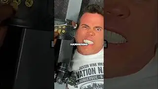 He Tried Everything To Get Cauliflower Ear