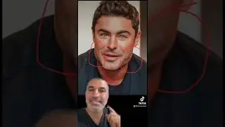 WHAT HAPPENED to Zac Efron's Jaw? Plastic Surgeon Explains!