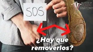 5 razones por las que los hombres pierden los TESTÍCULOS