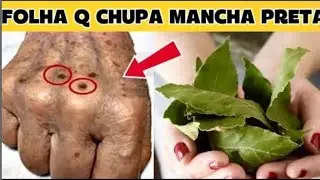 FOLHA QUE TIRA MANCHAS- FOI NA FILA DA UPA Que A DERMATOLOGISTA ME ENSINOU USAR!!