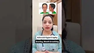 Snoring in Children | Adenoid Hypertrophy | Homeopathy Treatment | Mouth Breathing  #homeopathy