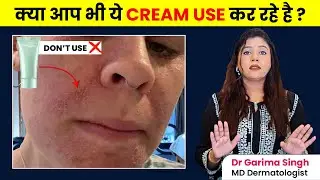 Kya Ye Creams Safe Hain? | Instant Glow Creams | Dermatologist Explains