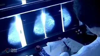 关注美国新饮食指南对癌症防治的影响