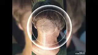 Very Outstanding Short Nape Shaved Bob Haircuts for All Women in 2026