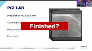 Optimizing PCI using FFR and HD IVUS - Part 1