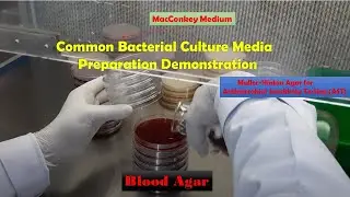 Macconkey, Blood and Muller-Hinton agar Preparation